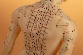 3 Questions to Ask When Searching for the Right Acupuncturist