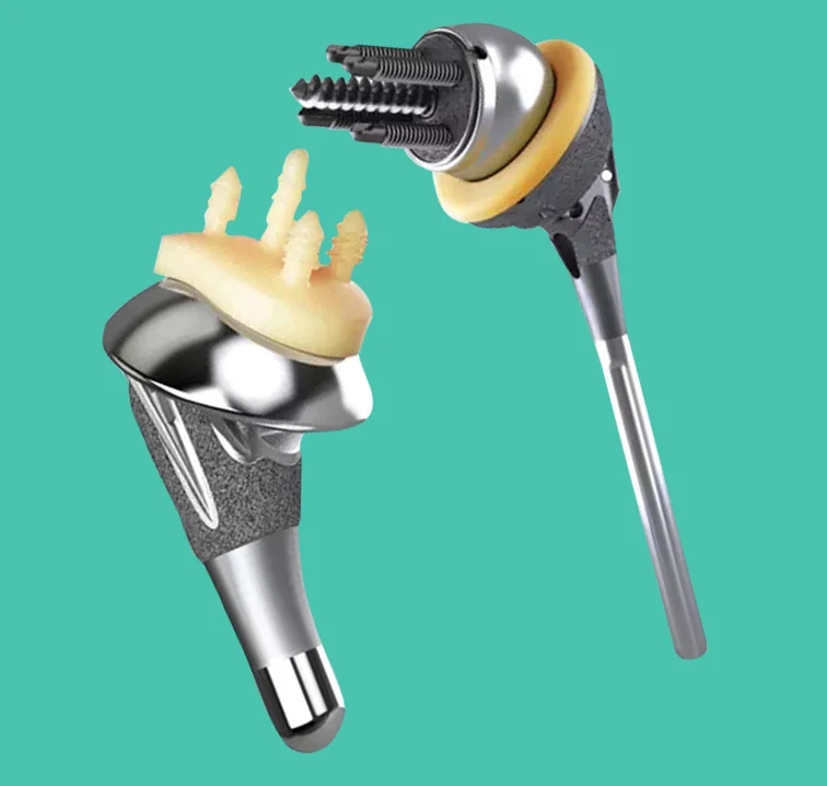 Joint Replacement Options for Different Joints