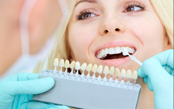 Dental Benefits That Support Employee Wellness: Creative Strategies For Today’s Workforce