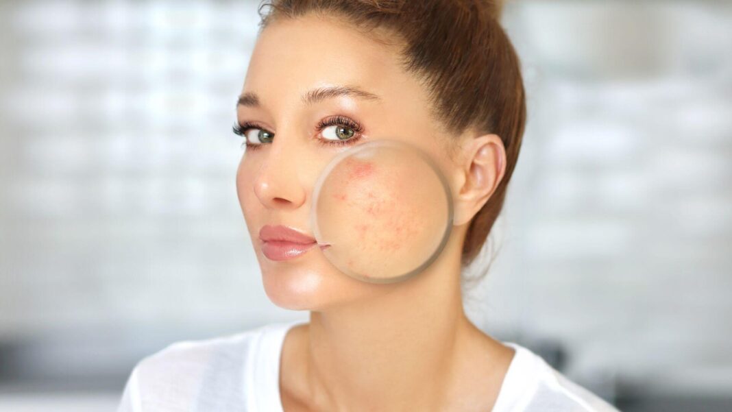 4 Ways Dermatologists Can Help Your Skin