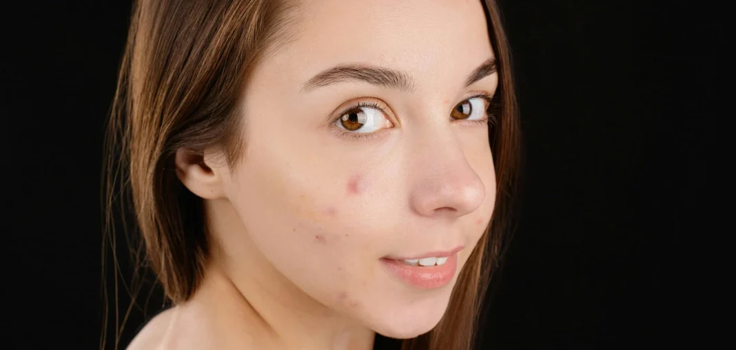 How Dermatology Advances Are Changing Skin Care Practices