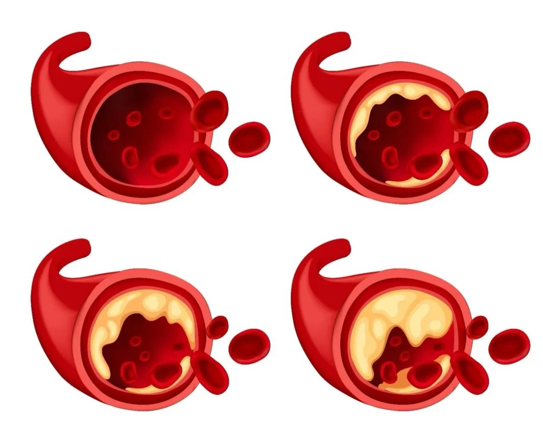 Innovative Treatments for Vascular Disease