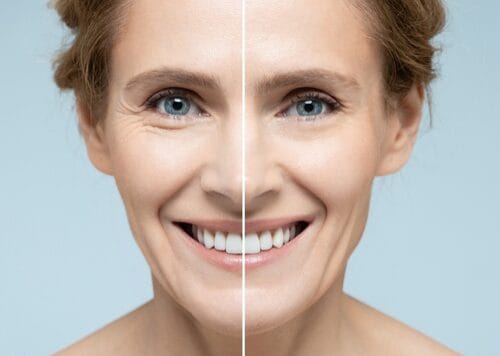 Questions To Ask When Looking for the Right Dermatologist