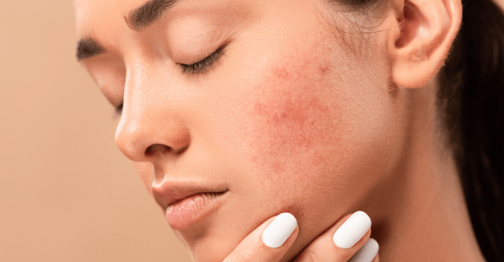 Skin Cancer Myths and Facts You Need to Know