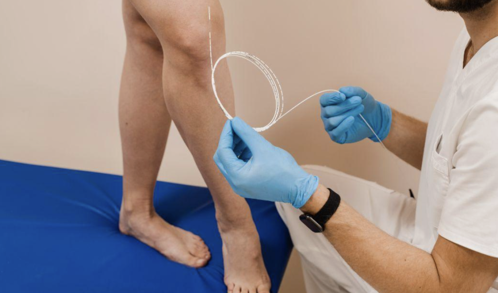 Why Choosing the Right Vein Clinic Can Improve Your Vein Health