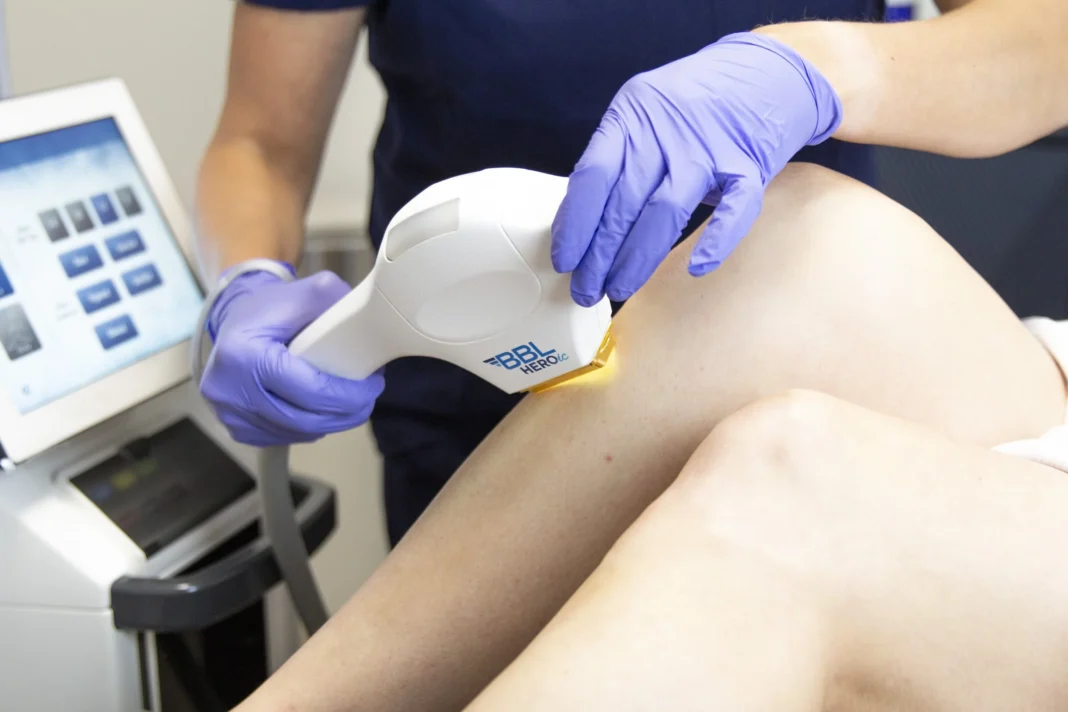 Navigating Your First Laser Hair Removal Treatment