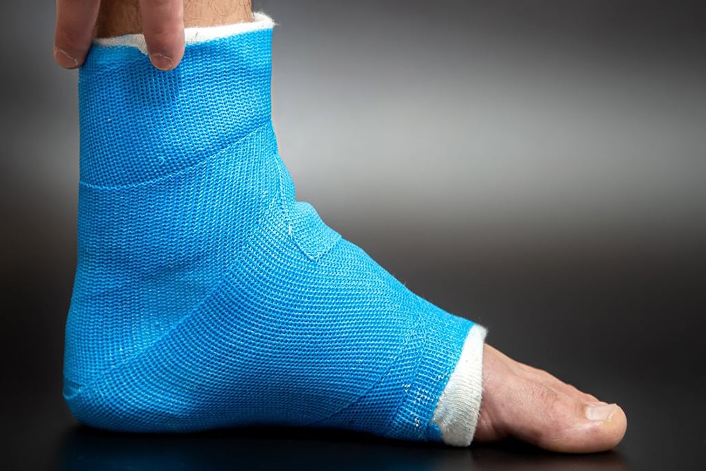 What to Expect During the Recovery Process After an Ankle Fracture